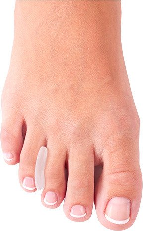 Межпальцевая перегородка Ortmann Molli / F-00055-05 (S)