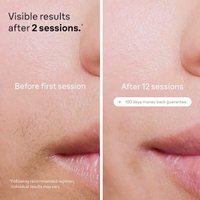 Фотоэпилятор Braun Silk-expert Pro 5 PL5242 в Борисове