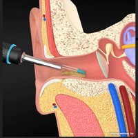 Умная ушная палочка Bebird Smart Visual Spoon Stick M9S (черный)