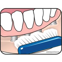 Зубная щетка TePe Implant/Ortho для имплантов и брекетов