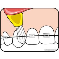 Монопучковая щетка TePe Interspace+ Soft (12 насадок)