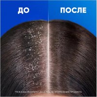 Шампунь Head & Shoulders Основной уход против перхоти 2 в 1 800 мл