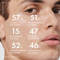  Vichy Normaderm с эффектом пилинга (125мл)