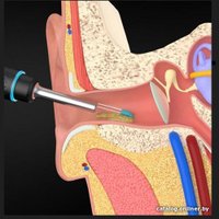 Умная ушная палочка Bebird M9 Pro (черный)