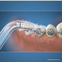 Насадка-щетка Waterpik Orthodontic Tip OD-100E