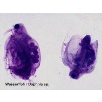 Набор микропрепаратов Bresser 74560 (25шт, в кейсе) в Витебске