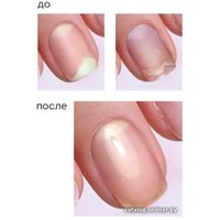 Лак Emi Антифунгал профилактика грибковых заболеваний