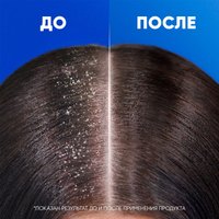  Head & Shoulders Яблочная свежесть против перхоти (800мл)