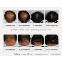 Шампунь La'dor против выпадения волос Dermatical Hair Loss 530 мл