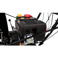 Снегоуборщик Champion STT761E