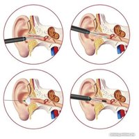 Умная ушная палочка Bebird Smart Visual Spoon Stick M9S (черный)